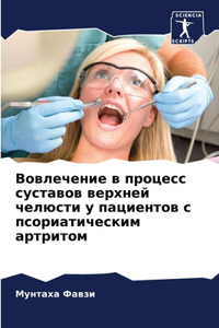 Вовлечение в процесс суставов верхней чел