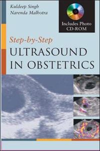 Step-by-Step Ultrasound in Obstetrics