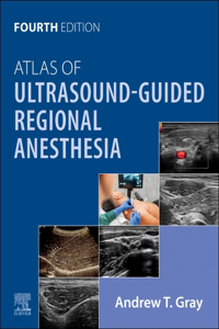 Atlas of Ultrasound-Guided Regional Anesthesia - E-Book