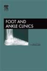 Surgery of the Hallux, An Issue of Foot and Ankle Clinics: v. 10-1 (The Clinics: Orthopedics)