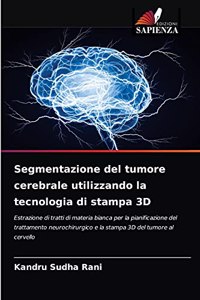 Segmentazione del tumore cerebrale utilizzando la tecnologia di stampa 3D