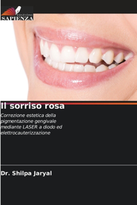 sorriso rosa