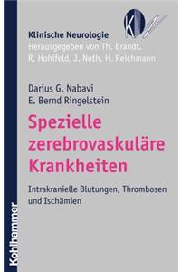 Spezielle Zerebrovaskulare Krankheiten: Intrakranielle Blutungen, Thrombosen Und Ischamien