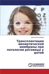 Transplantatsiya Amnioticheskoy Membrany Pri Patologii Rogovitsy U Detey