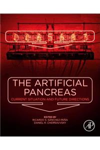 Artificial Pancreas