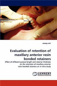 Evaluation of Retention of Maxillary Anterior Resin Bonded Retainers