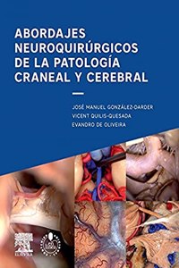 Abordajes neuroquirurgicos de la patologia craneal y cerebral