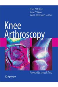 Knee Arthroscopy