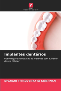 Implantes dentários