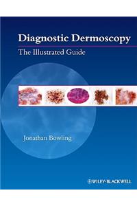 Diagnostic Dermoscopy