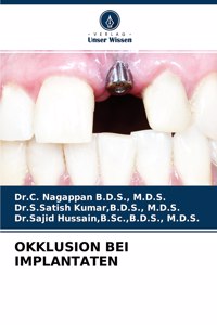 Okklusion Bei Implantaten