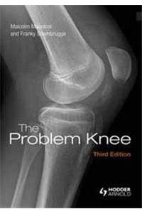 THE PROBLEM KNEE,2/E, 2003