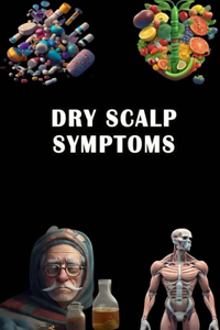 Dry Scalp Symptoms