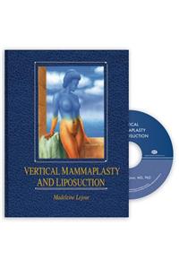 Vertical Mammaplasty and Liposuction