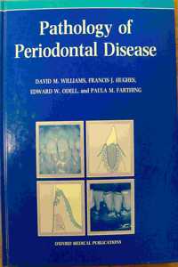 Pathology of Periodontal Disease