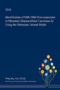 Identification of Mir-106b Over-Expression in Metastatic Hepatocellular Carcinoma by Using the Orthotopic Animal Model