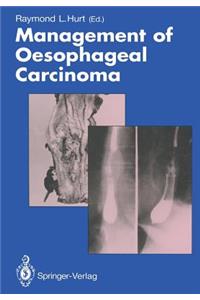 Management of Oesophageal Carcinoma