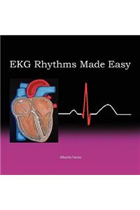 EKG Rhythms Made Easy