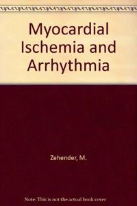 Myocardial Ischemia And Arrhythmia