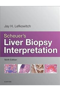 Scheuer's Liver Biopsy Interpretation E-Book