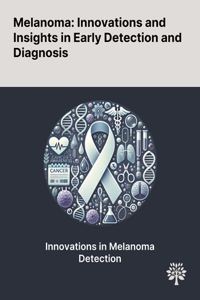 Melanoma