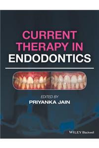 Current Therapy in Endodontics