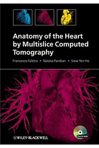 Anatomy of the Heart by Multislice Computed Tomography