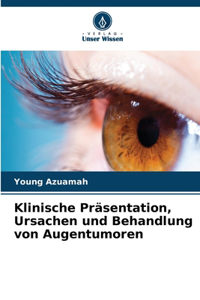 Klinische Präsentation, Ursachen und Behandlung von Augentumoren