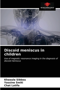 Discoid meniscus in children