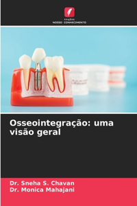 Osseointegração