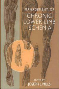 Management of Chronic Lower Limb Ischemia