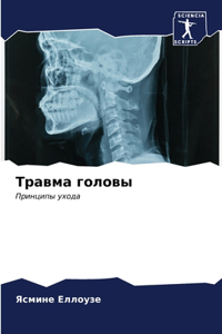 Травма головы