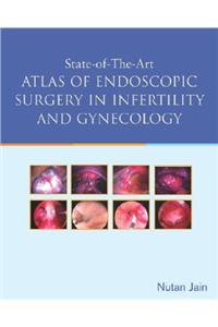 State of the Art Atlas of Endoscopic Surgery in Infertility and Gynecology