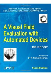 A Visual Field Evaluation with Automated Devices