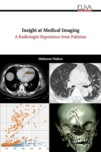 Insight at Medical Imaging