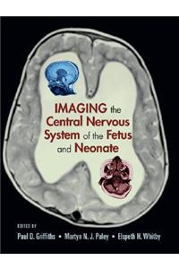 Imaging the Central Nervous System of the Fetus and Neonate