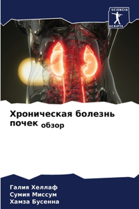 Хроническая болезнь почек обзор