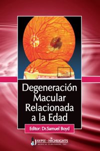 Degeneracion Macular Relacionada a la Edad