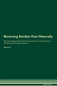 Reversing Swollen Feet