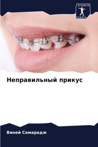 Неправильный прикус