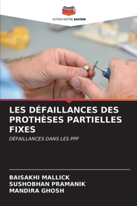Les Défaillances Des Prothèses Partielles Fixes