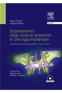 Superamento Degli Ostacoli Anatomici in Chiurgia Implantare