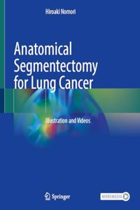 Anatomical Segmentectomy for Lung Cancer
