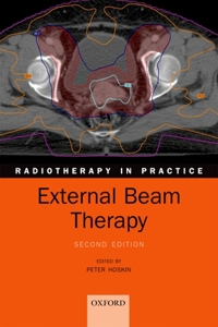 External Beam Therapy