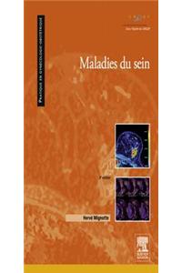 Maladies Du Sein