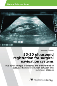 3D-3D ultrasound registration for surgical navigation systems