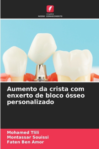 Aumento da crista com enxerto de bloco ósseo personalizado