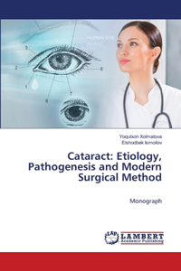 Cataract