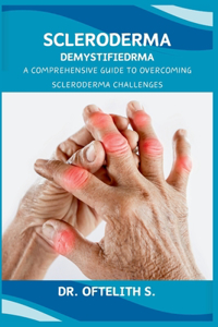 Scleroderma Demystified