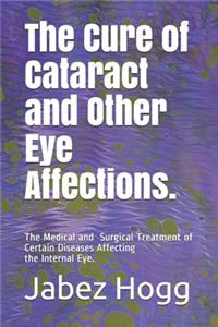 The Cure of Cataract and Other Eye Affections.